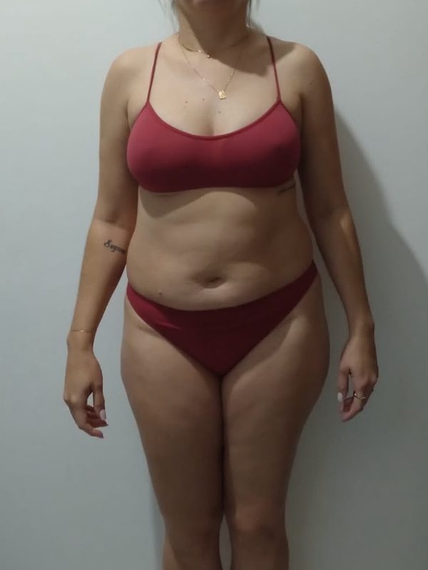 Aluna da Alana de frente, antes